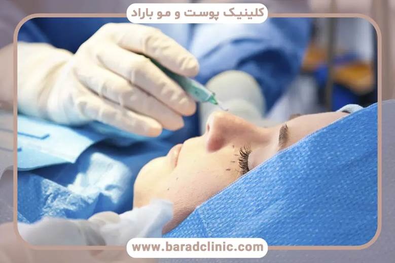 بررسی هزینه و عوامل مؤثر بر قیمت جراحی پلک