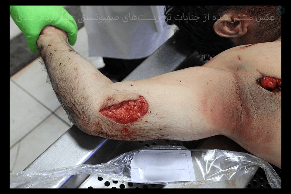 قتل عام مردم ایران توسط عوامل موساد