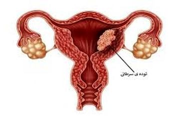 این علائم هشدار سرطان دهانه رحم را می دهند!