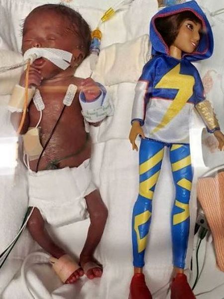 کوچکترین نوزاد دنیا متولد شد+عکس