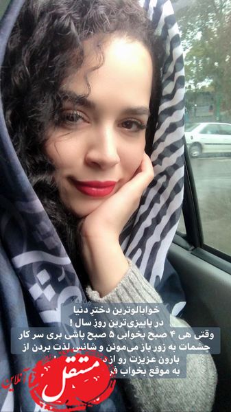وقتی خانم بازیگر با چشمان بادکرده به سرکار میرود + عکس