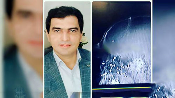 ترور پزشک بیماران کرونایی برای دومین بار + عکس