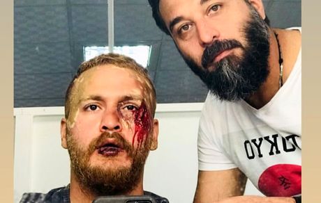 گریم زخمی و خونی میلاد کی مرام + عکس