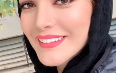 چهره جذاب متین ستوده + عکس