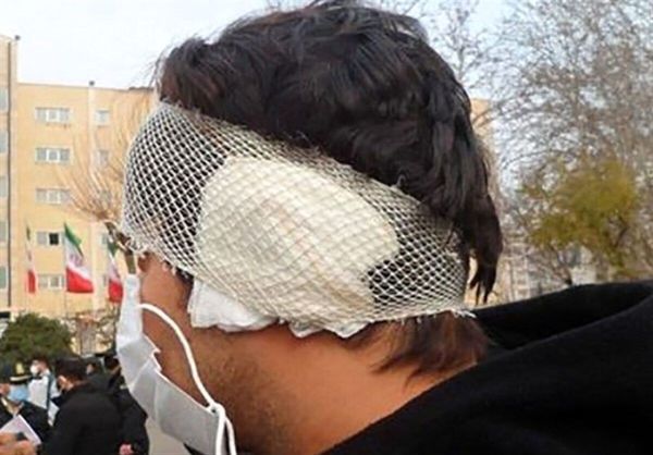 یک مرد با دندان گوش پسر جوان را کند!