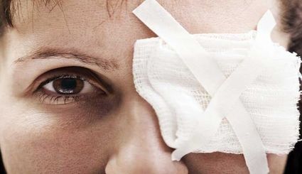 آسیب دیدگان چشمی در حوادث اخیر هرچه سریعتر به مراکز درمانی مراجعه کنند/ شاید خیلی زود، دیر شود