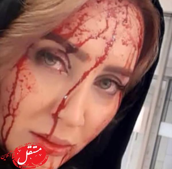 صورت خونی خانم بازیگر + عکس