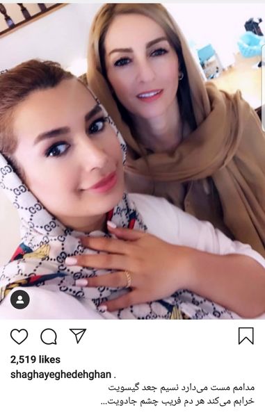 چهره جدید شقایق دهقان با تزریق ژل + عکس